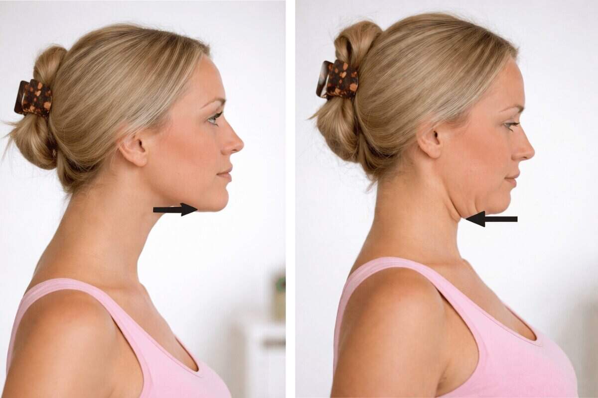 ejercicio de retracción cervical para aliviar cefalea tensional